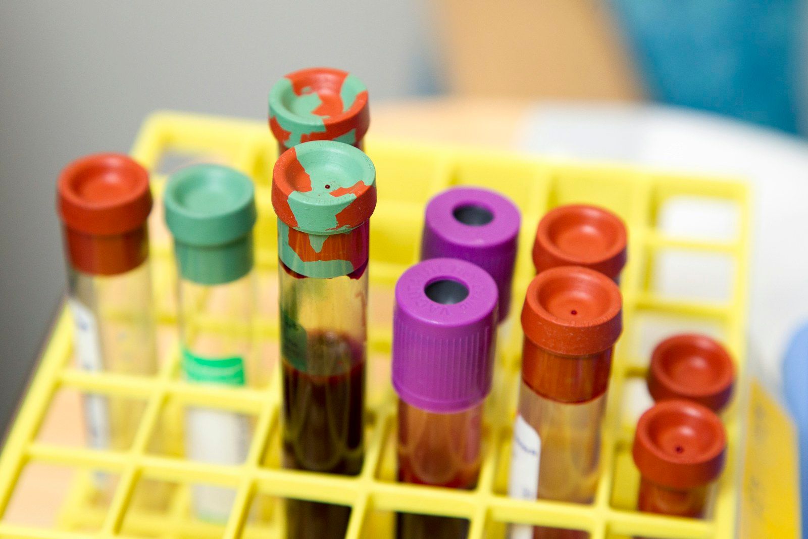 Blood sample vials in a laboratory